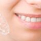 clear aligner