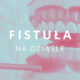 fistuła