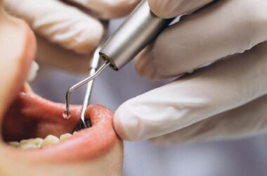 implanty zębowe cała szczęka cena