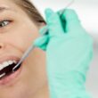 odrzucenie implantu zęba objawy