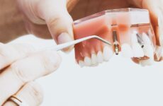 tymczasowa proteza na jednego zęba