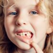 zapalenie jamy ustnej u dzieci