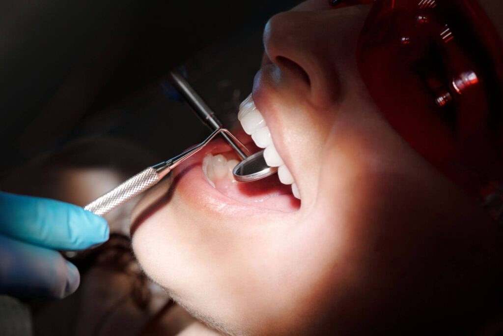Ból zęba pod koroną dentysta