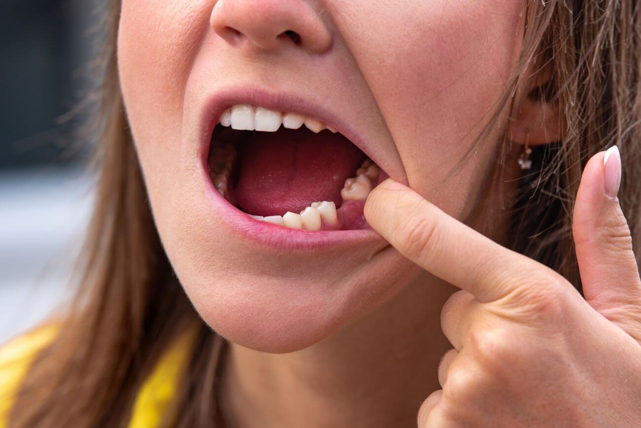 zakażenie po wyrwaniu zęba objawy