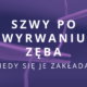 kiedy zakłada się szwy po wyrwaniu zęba