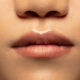 mucocele