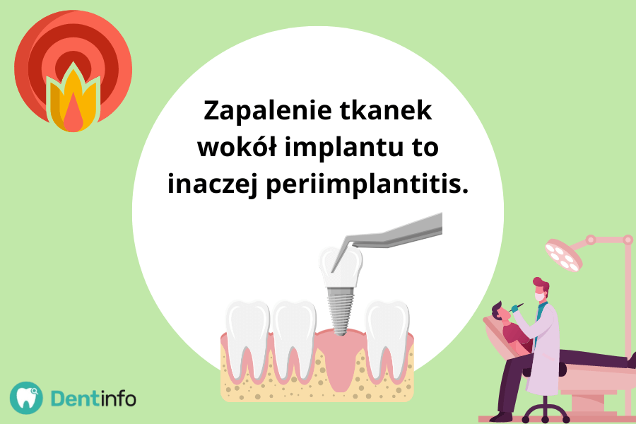 Zapalenie tkanek wokół implantu to inaczej periimplantitis.