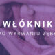włóknik po wyrwaniu zęba jak wygląda