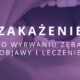 zakażenie po wyrwaniu zęba objawy